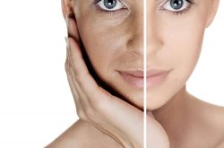 Treatment for Pigmentation – Skinologycentre in Bangalore India