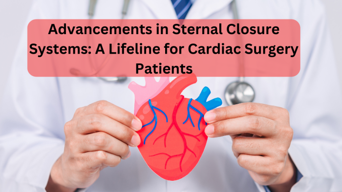 Advancements in Sternal Closure Systems A Lifeline for Cardiac Surgery Patients