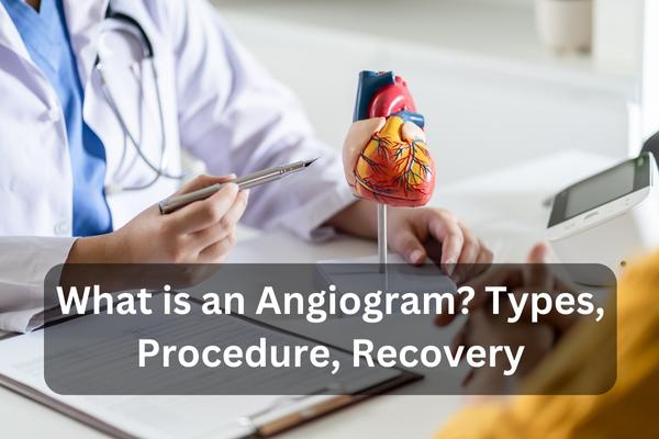 What Is An Angiogram? Types, Procedure, Recovery