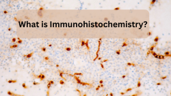 What Is Immunohistochemistry ?