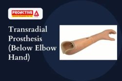 Transradial Prosthesis (Below Elbow Hand) Products