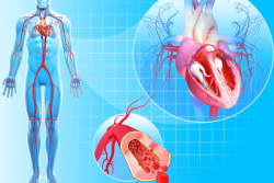 The Role Of Cardiovascular Information Systems In Healthcare