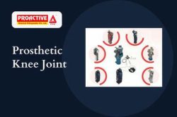 Knee Joint Replacement Prosthesis