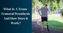 What is (above the knee) Trans-Femoral Prosthesis?